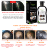 Pack Anticaída Disaar – Shampoo + Sérum